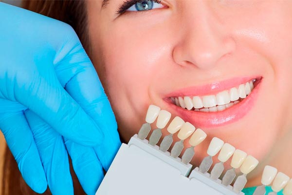 عمر روکش دندان و راههای افزایش عمر روکش