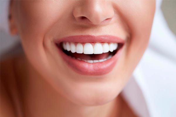 فرق بین لمینت و کامپوزیت دندان