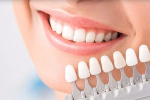 روکش دندان فوری