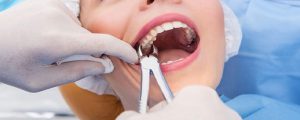 دارو و فعالیت بدنی پس از کشیدن دندان