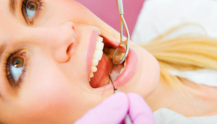 روش های ترمیم دندان پوسیده