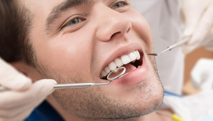 مزایای روکش دندان