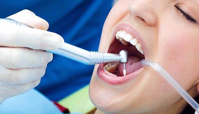 چه زمانی به عصب کشی دندان نیاز داریم؟