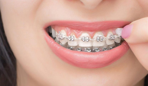 ارتودنسی دندان