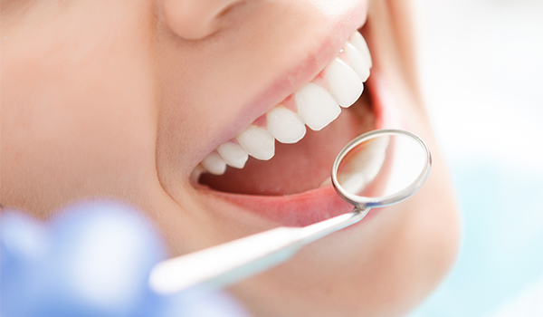 کامپوزیت دندان