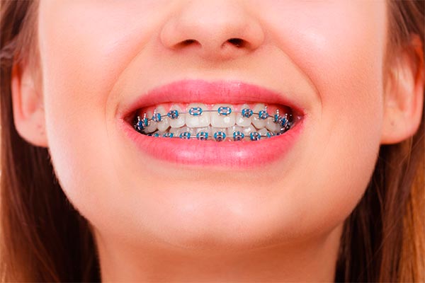 ارتودنسی دندان چیست؟