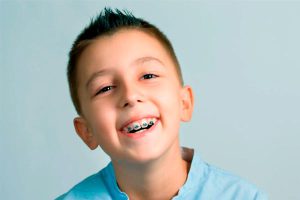 ارتودنسی کودکان