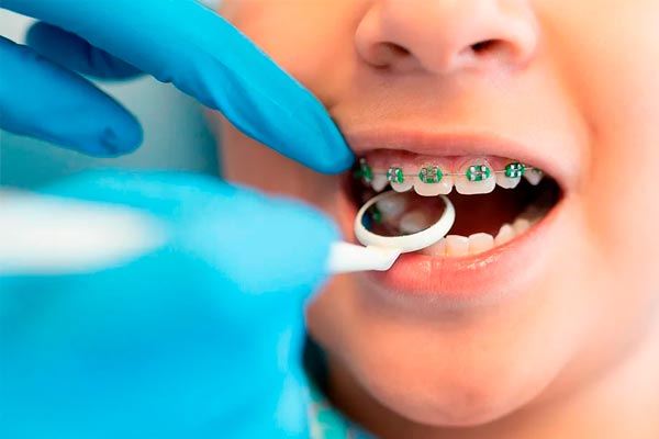 درمانهای ارتودنسی چه کمکی به کودک می کند