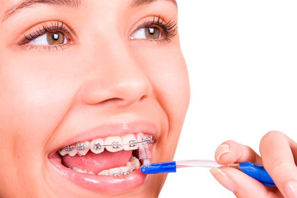 ارتودنسی دندان چقدر طول میکشد؟
