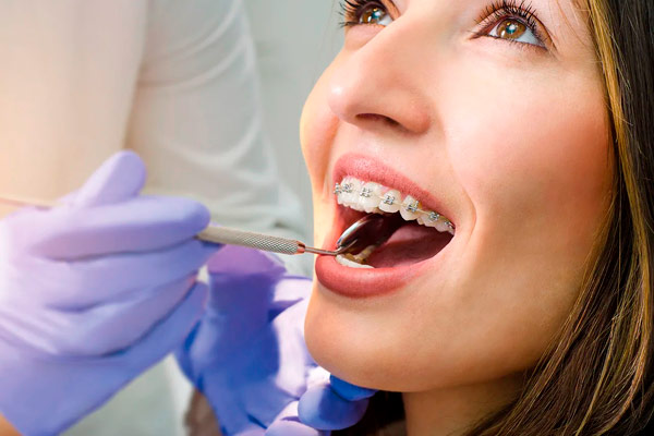 انواع درمان ارتودنسی